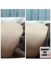 エルミオ エスパシオ ミロク(El mio espacio 369miroku)/カーボキシーパック～お腹編～