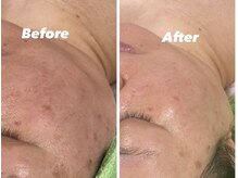 ビビューティー(美Beauty)の雰囲気（ご不安な方は、まずは無料なカウンセリングにてご相談ください！）