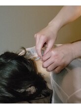 悠雲(ユウウン)/鍼治療