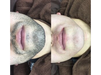 ニコプラス(NICO+)/