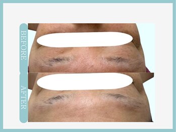 アコガレコガオ 仙台店/