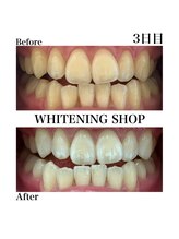 ホワイトニングショップ 豊川店/Before After　3日目のお客様