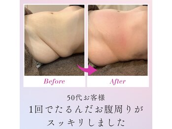 デイスパ ヴィータの写真/【お腹まわりの痩身】そのお腹そのやり方では痩せません!
