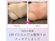 デイスパ ヴィータの写真/【お腹まわりの痩身】そのお腹そのやり方では痩せません!