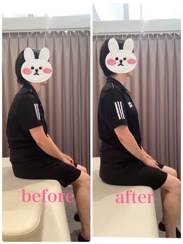 いおり骨盤整体 リブート(RE:BOOT)/姿勢矯正ビフォーアフター