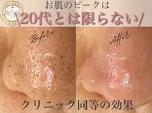 エミナル(eminal)