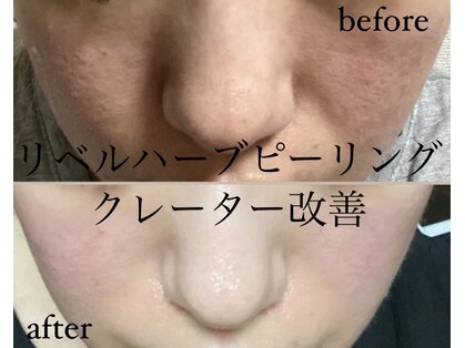 ココ(COCO)の写真