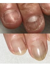 イズム(Izm)/上before/下after 約3ヶ月時点