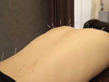ナック整骨院/■鍼灸■