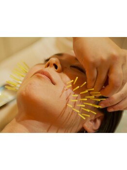 小顔になりたい