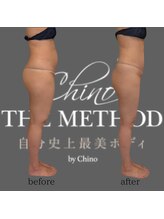 エミナル(EMINALu)/ぽっこりお腹／骨盤矯正