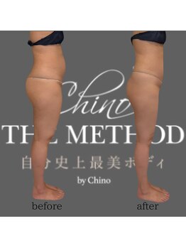 エミナル(EMINALu)/ぽっこりお腹／骨盤矯正