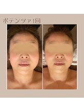 ナナイロ(nanairo)/ポテンツァ×エクソプレミアム