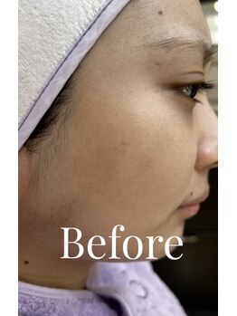 エリス(ELISSE)/Before