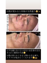 サロン ド マーシャ(salon de Marsha)/素敵な彼