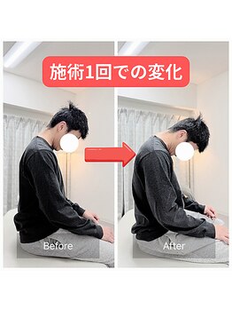 寿 天王寺院(KOTOBUKI)/天王寺/整体/肩こり/姿勢改善