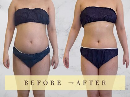 ラナ(LaNa)の写真