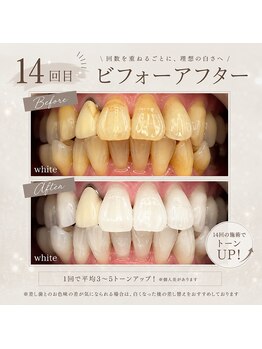 ホワイト 上乃木南店(WHITE)/14回目ビフォーアフター