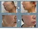 ヴィノス 麻布十番(VENUS)の写真