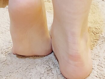 ラディアンス(Radiance)/どの角度から見ても綺麗な足元へ