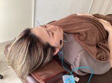 ハリファ鍼灸院 横浜関内院(HariFa鍼灸院)/美容施術