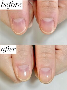 ニコワイズネイル(Nico Y's Nail)/【自爪育成コース】