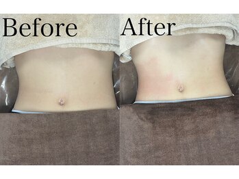 ブレスト サロン 奈良店(Bryst Salon)/痩身施術