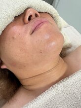 ミセレルオカザキ(MISEREL OKAZAKI)/