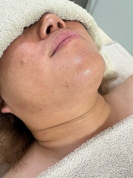 ミセレルオカザキ(MISEREL OKAZAKI)/