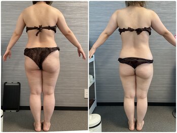 美容整体ウェリナ 名駅院/小顔矯正/骨盤矯正/美脚サロン