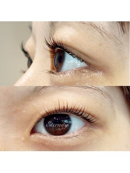 エタニティ(eternity)/パロジェンヌラッシュリフト