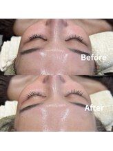 ラシンバン(Lashinvan)/ララピール