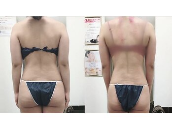 アイディエム 恵比寿店(IDM)/モニター募集★