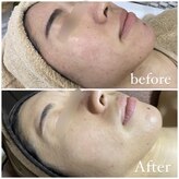 ソレヴィア(SOLEVIA)