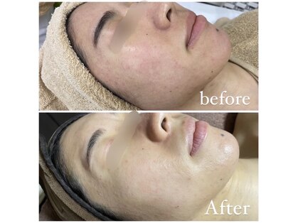 ソレヴィア(SOLEVIA)の写真