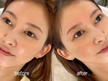 ラシサ(LASHISA)の写真/【目元をトータルで整える】まつ毛×眉毛の同時施術で垢抜けた印象へ♪