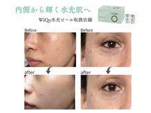 ハク(8AK)の雰囲気（話題の水光ピール取り扱い店舗♪初回価格9900円）