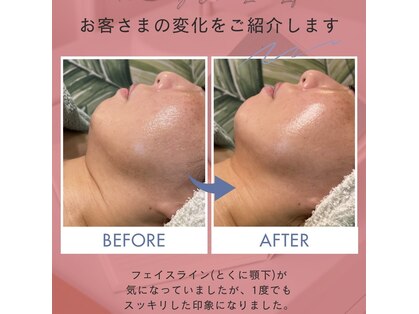 ルアナライフ(Luana Life)の写真