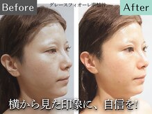 グレースフィオーレ 南越谷店(gracefiore)