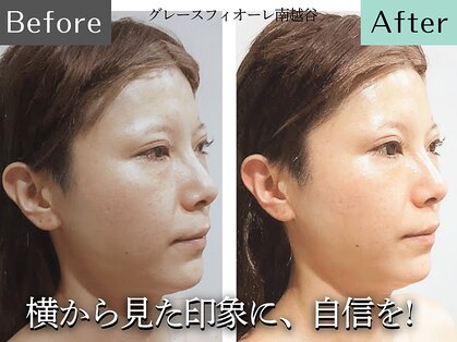 グレースフィオーレ 南越谷店(gracefiore)の写真