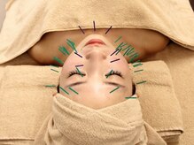 カイ(Kai)の雰囲気(お悩みに合わせたオーダーメイド美容鍼【たるみ/リフトアップ】)