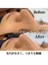 エムラボ 渋谷店(M LABO)/ビフォーアフター