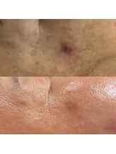 エン(enn)/【黒ずみ・トーンアップ】