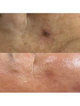 エン(enn)/【黒ずみ・トーンアップ】