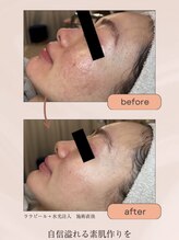 モモ(momo)/自信あふれる素肌作り