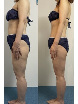 シェリスパ(Cheri Spa)/2ヶ月て別人に!!美しいラインへ