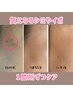 今のうちに【気になるシミをケア】してメイク時短♪1箇所¥500