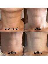 エステティックサロン S/首シワケア！