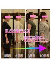 整体院ヒカリノキュウジツ 鹿沼店/整体　肋骨　ストレートネック