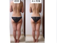 ティーズルーム(T's Room)/ブライダル痩身